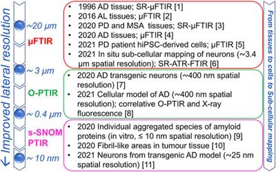 Contribution of Infrared Spectroscopy to the Understanding of Amyloid Protein Aggregation in Complex Systems